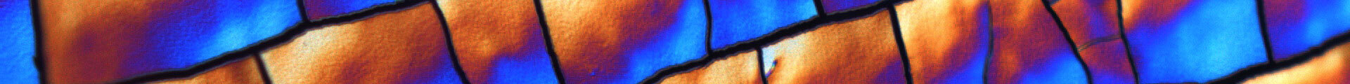 Corrosion protection